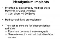 Profile on neodymium implants